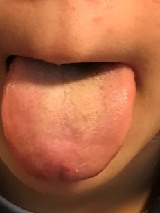 舌