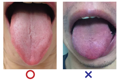舌の正しい撮影写真